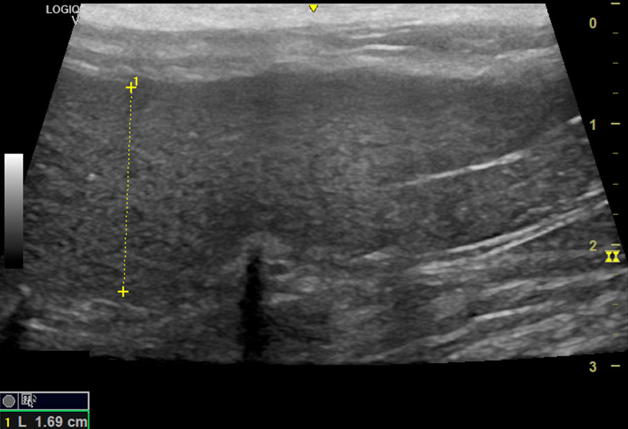 Aggregata Caso Clínico - PIF Neurológico y ocular en un gato 3 Sin titulo 4